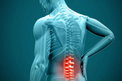 Lumbar Decompression